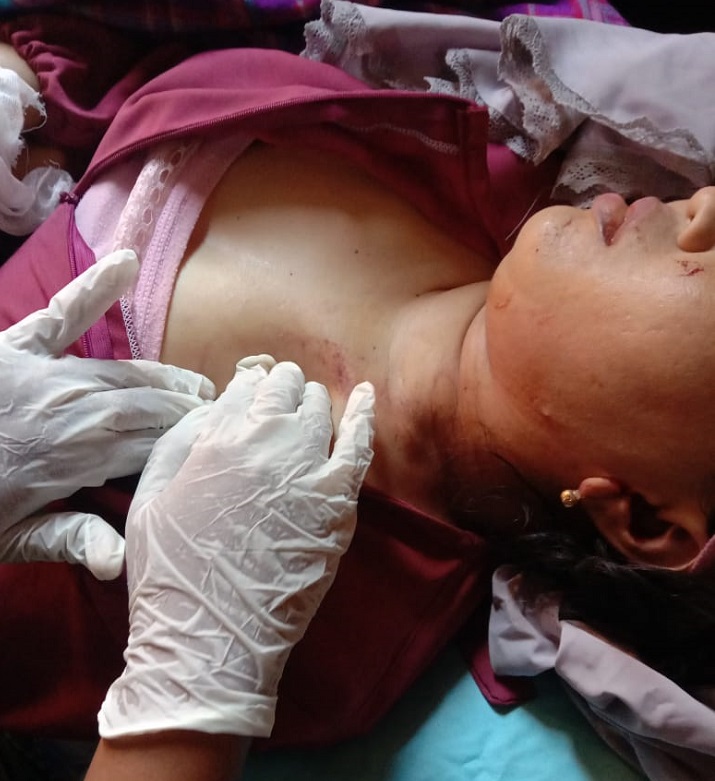 Na'as, Seorang Perempuan Tewas Terlindas Truk